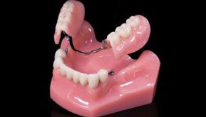 Dental-attatchments2